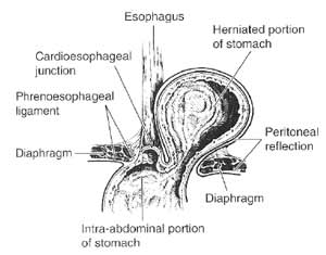 esophagus-2